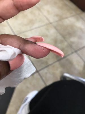 My finger cut