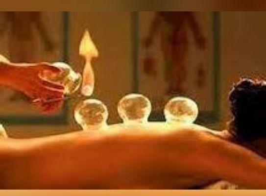 Offering fire cupping and plastic cupping sessions!