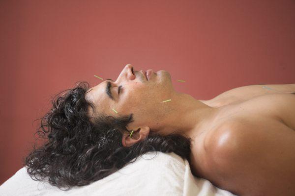 Person relaxing with acupuncture needles in face