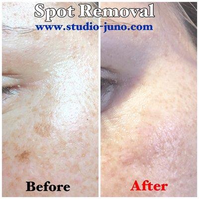 Spot Removal