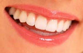 Porcelain veneers, whitening or invisible braces for that naturally beautiful smile!