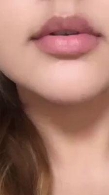 lips before, no lumps and symmetrical