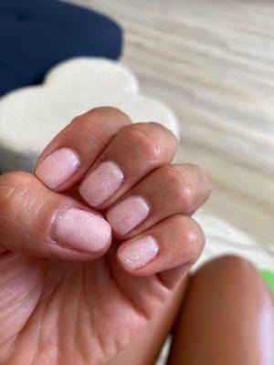 Bad gel manicure