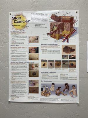 Understanding skin cancer!