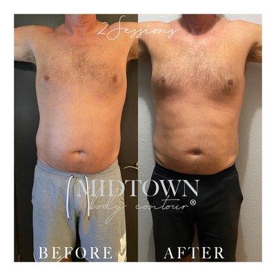 Midtown Body Contour