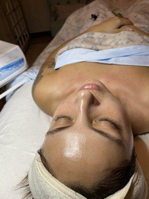 Facial with lactic peel -look at that glow!