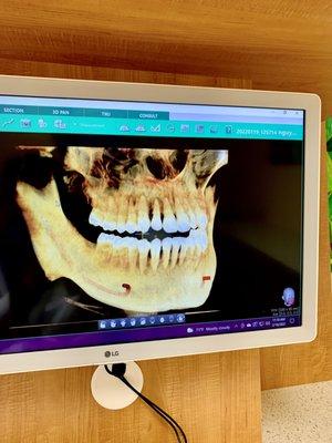 state of the art 3D X-ray