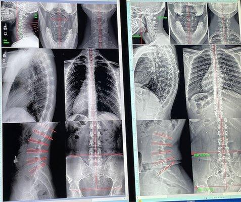 X-ray comparison