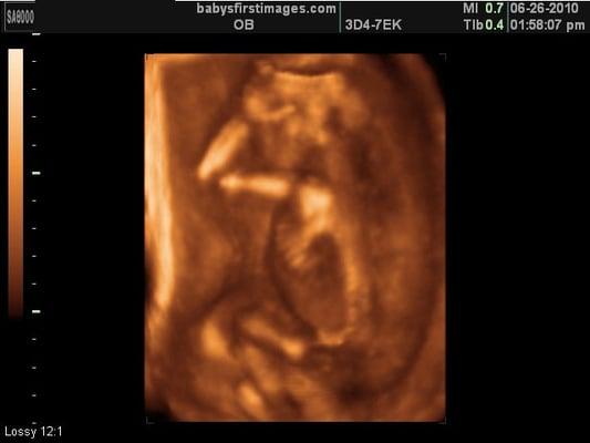 Baby's First Images Ultrasound