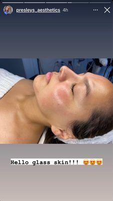 Dermaplaning