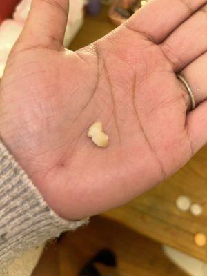 A tooth.