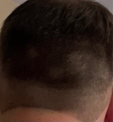 Buzzed patches and an obvious line where there should be a fade.