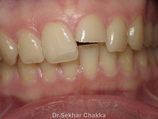 Case 3 Dental Emergency (before)