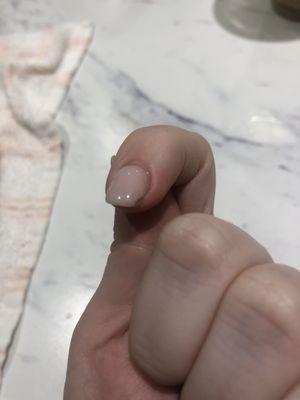 Chipped left pointer finger