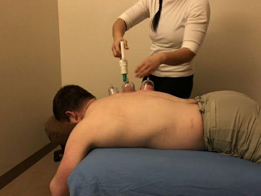 Applying a vacuum cup to an adhesion on the client's back.