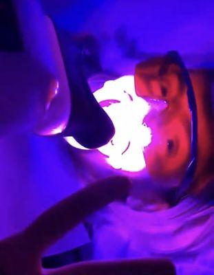 America's top teeth whitening system available at Lavana Medspa in New Hartford, NY!