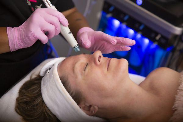 HydraFacial Gold Treatment