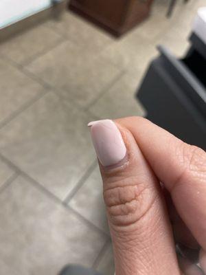 Crack and cuticle all over