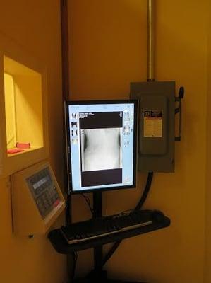 Digital X-ray equipment