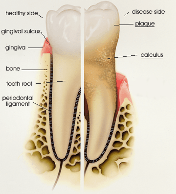 Periodontist