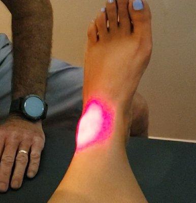 Cold Laser Therapy