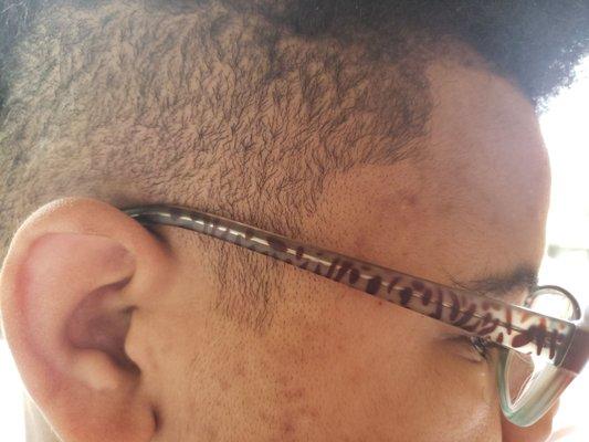 What kind of barber goes all into a hairline like this?