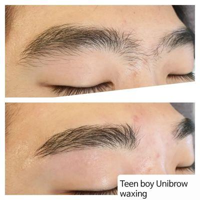 Teen unibrow