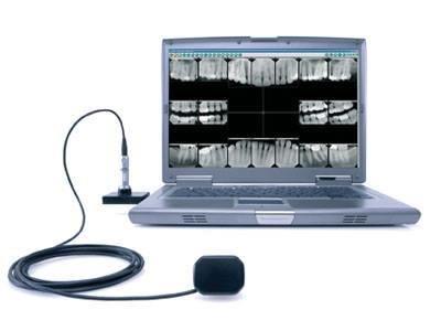 Digital Xrays translates to faster images and reduced radiation exposure for the patient