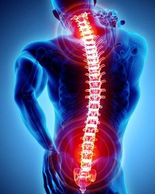 Pain relief for back pain