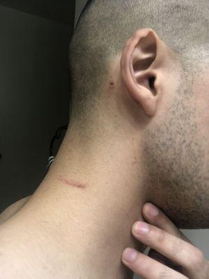 Cuts on neck/ear