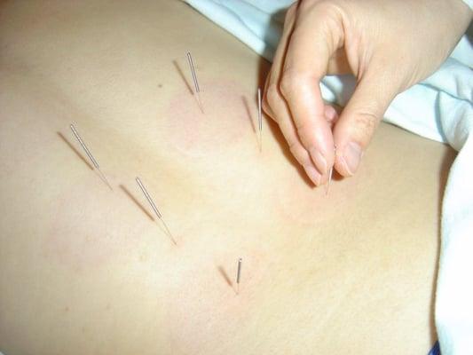 Kyoung Cho Acupuncture Clinic