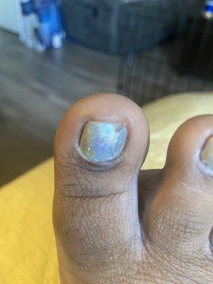 Chipped toenails 3 days gel polish