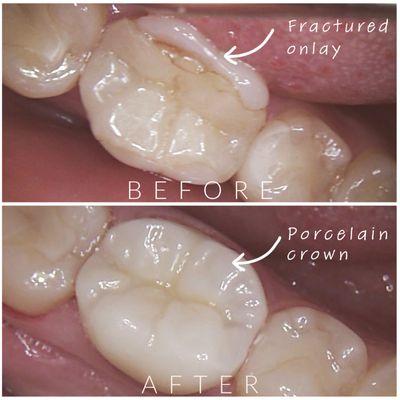 Restoration by Dr. Tatyana Yashchuk