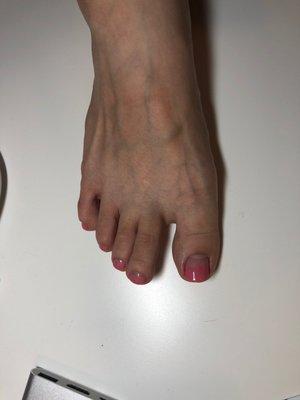 Gel pedi