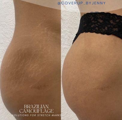 Stretch marks Inkless