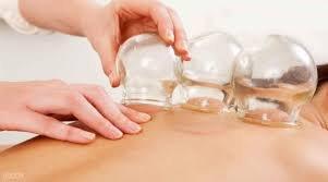 Cupping is great for relieving muscle tightness, improving circulation and facilitating elimination of toxins and stagnant blood.