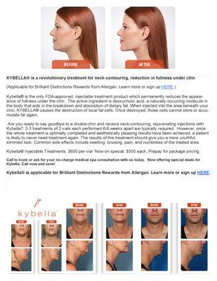 Special Kybella Pricing, call now