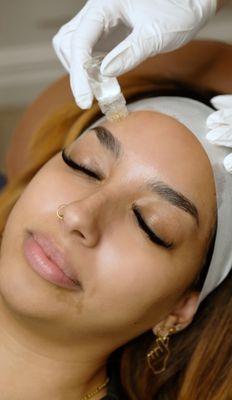 Medical Grade Skin Treatments