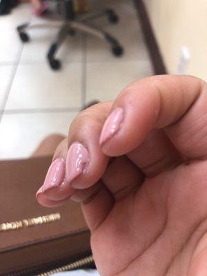 Crappy job on shaping the nail.