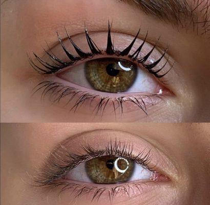 lash Botox before and after