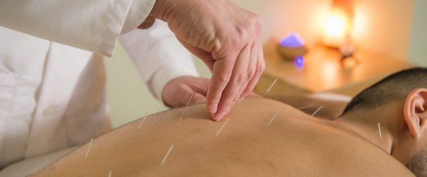 Raul's acupuncture services are covered by the VA.