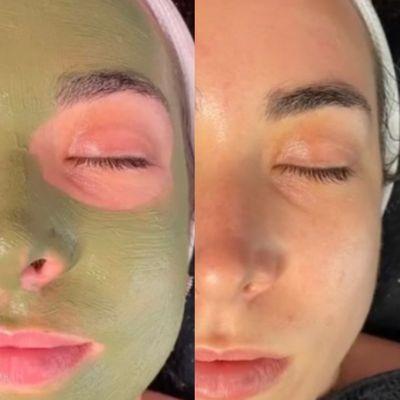 Glam Facial and Microdermabrasion