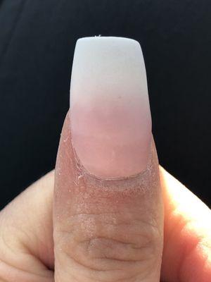 What my thumb looked like right before she was going to put clear on