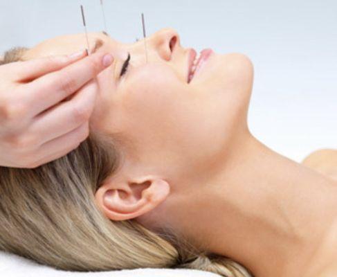 We practice traditional Chinese acupuncture and dry needling!