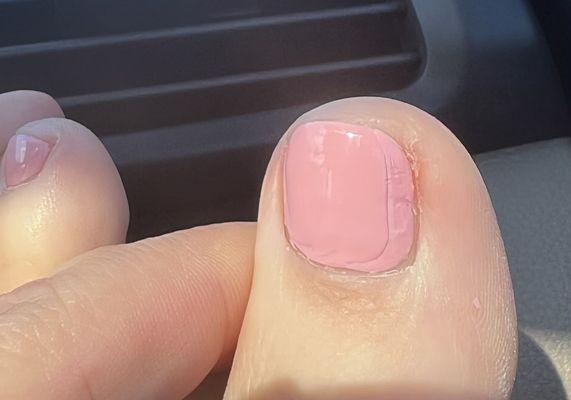 Poor nail polish application