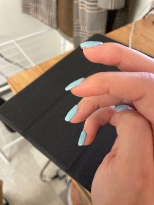 Uneven nails with apex too high