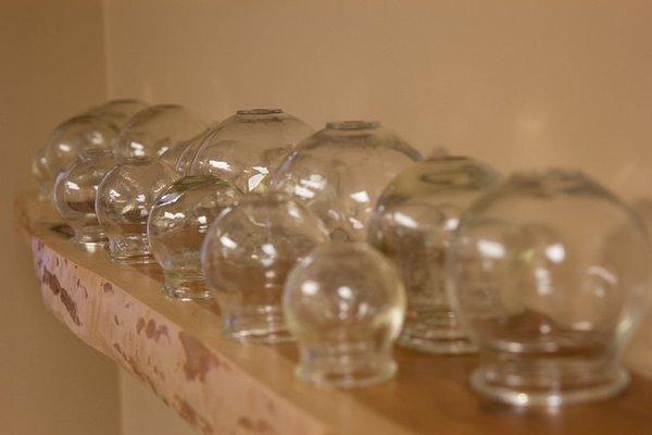 Cupping for achy and painful muscles