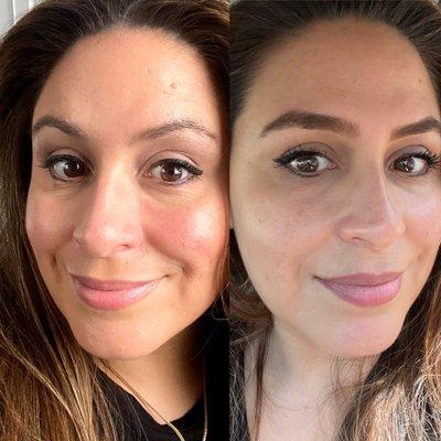 Brow Transformation