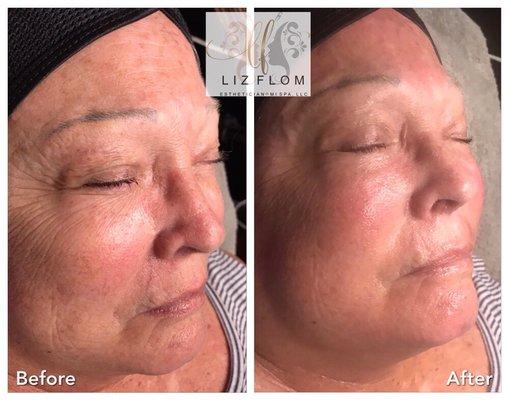 Korean Skin Care Treatment...age reversing!!