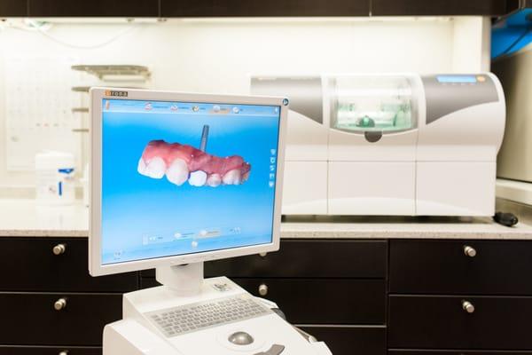 One visit crowns with CEREC